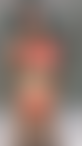 Geblurrte Content-Vorschau
