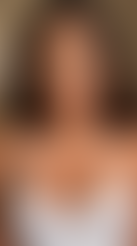 Geblurrte Content-Vorschau