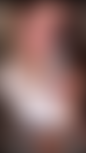 Geblurrte Content-Vorschau