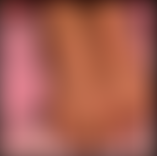 Geblurrte Content-Vorschau