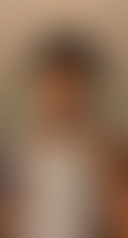 Geblurrte Content-Vorschau