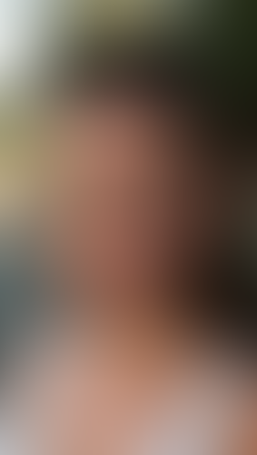 Geblurrte Content-Vorschau