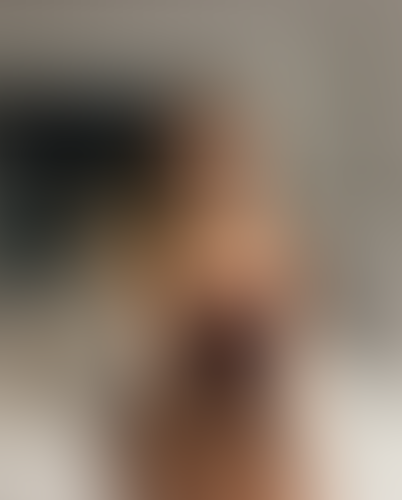 Geblurrte Content-Vorschau