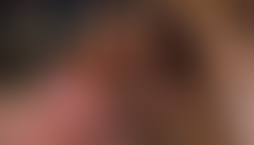Geblurrte Content-Vorschau