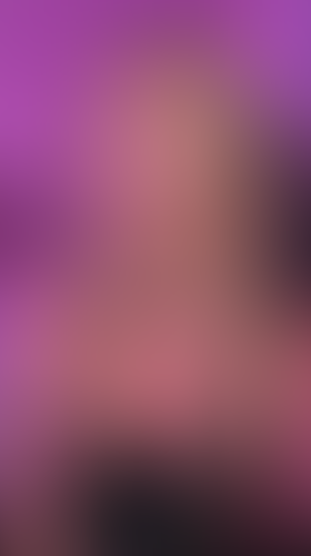 Geblurrte Content-Vorschau