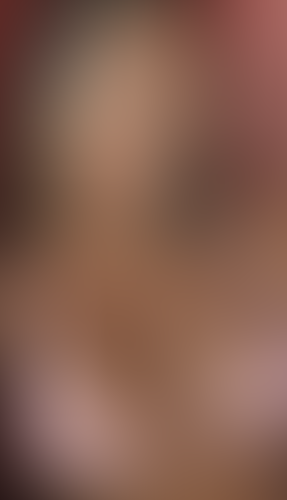 Geblurrte Content-Vorschau