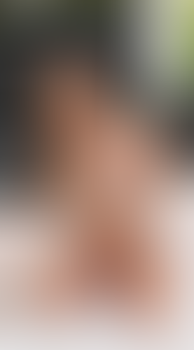 Geblurrte Content-Vorschau