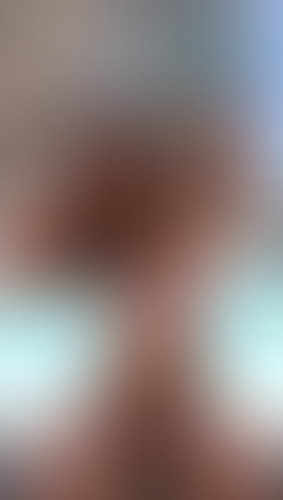 Geblurrte Content-Vorschau