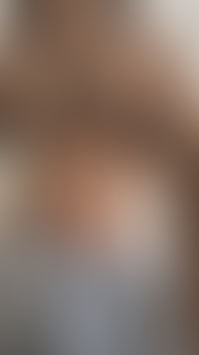 Geblurrte Content-Vorschau