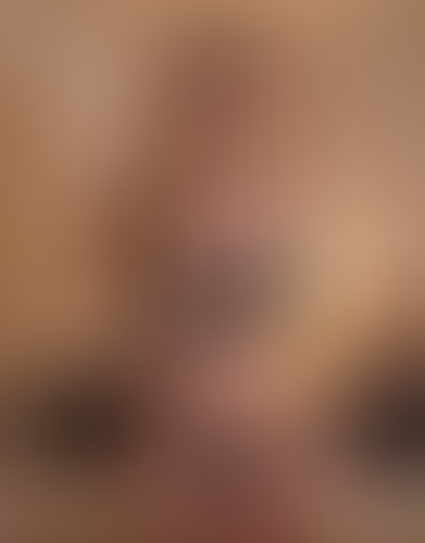 Geblurrte Content-Vorschau