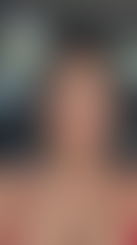 Geblurrte Content-Vorschau
