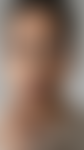 Geblurrte Content-Vorschau