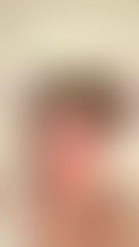 Geblurrte Content-Vorschau