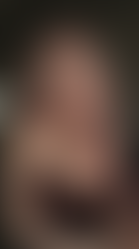 Geblurrte Content-Vorschau
