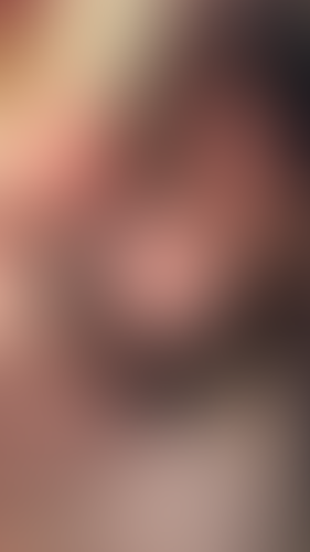 Geblurrte Content-Vorschau
