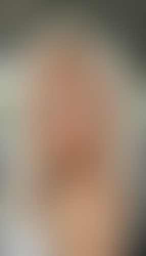 Geblurrte Content-Vorschau
