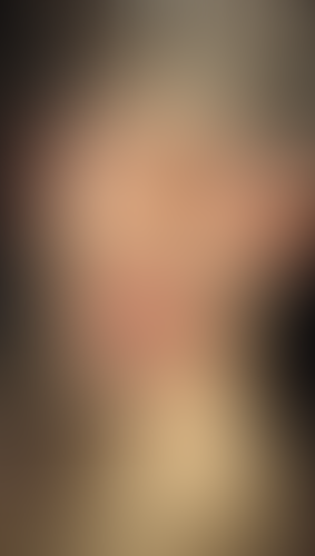 Geblurrte Content-Vorschau
