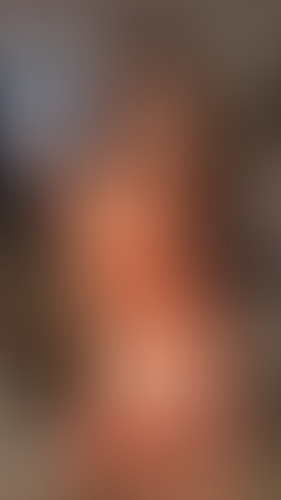 Geblurrte Content-Vorschau