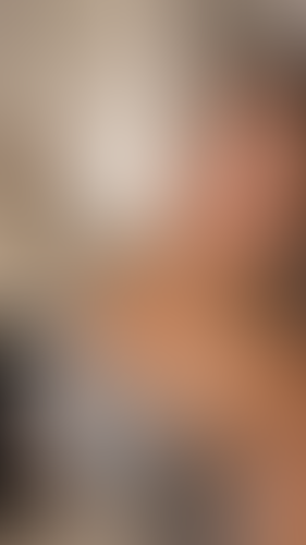 Geblurrte Content-Vorschau