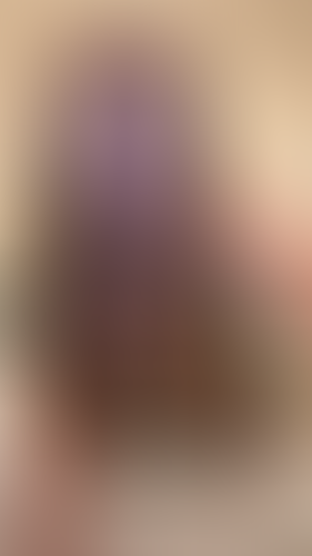 Geblurrte Content-Vorschau