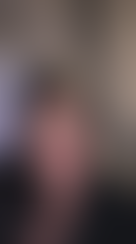 Geblurrte Content-Vorschau