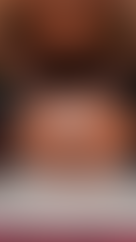 Geblurrte Content-Vorschau