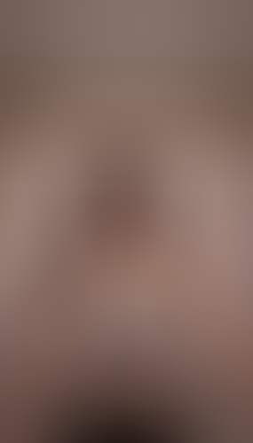 Geblurrte Content-Vorschau