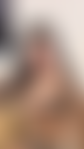 Geblurrte Content-Vorschau