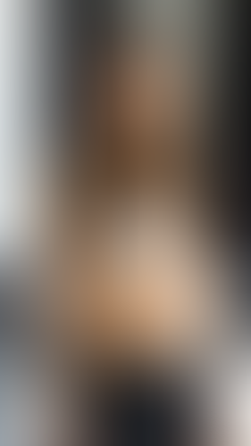 Geblurrte Content-Vorschau