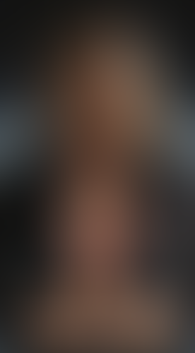Geblurrte Content-Vorschau