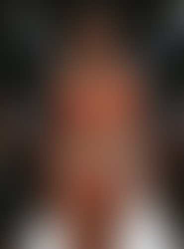 Geblurrte Content-Vorschau