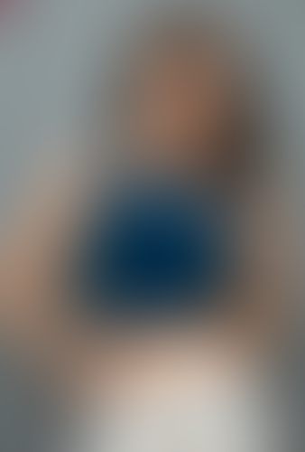 Geblurrte Content-Vorschau