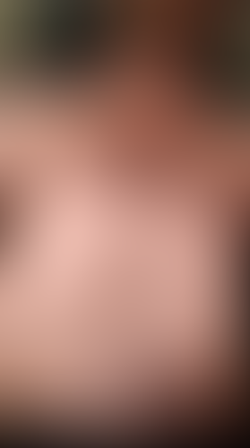 Geblurrte Content-Vorschau