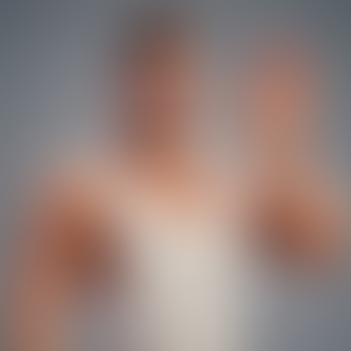 Geblurrte Content-Vorschau