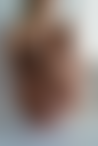 Geblurrte Content-Vorschau