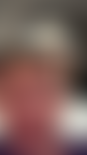 Geblurrte Content-Vorschau