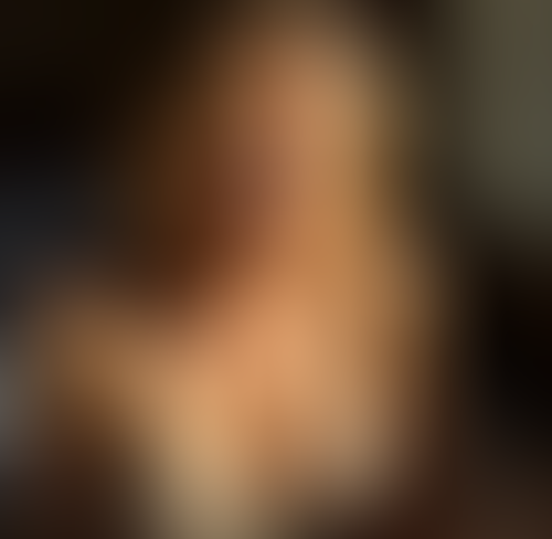 Geblurrte Content-Vorschau