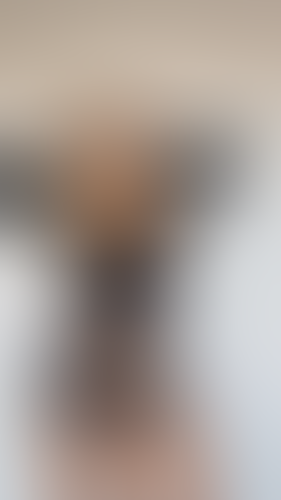 Geblurrte Content-Vorschau