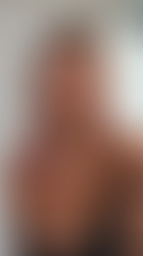 Geblurrte Content-Vorschau