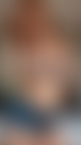 Geblurrte Content-Vorschau