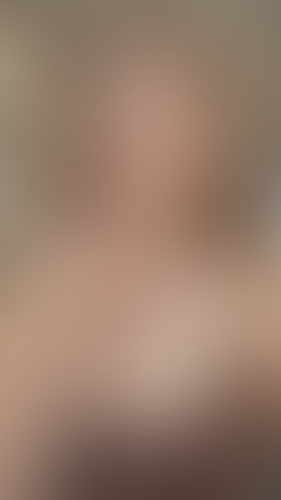 Geblurrte Content-Vorschau