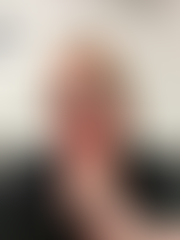 Geblurrte Content-Vorschau