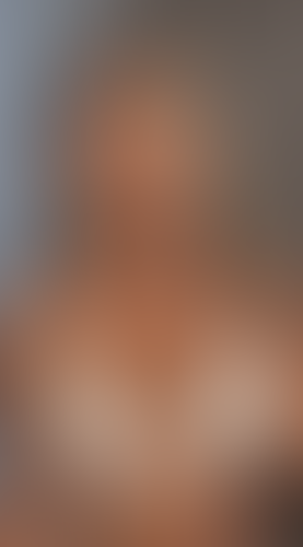 Geblurrte Content-Vorschau