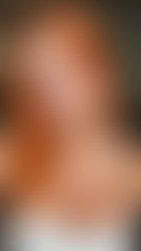 Geblurrte Content-Vorschau