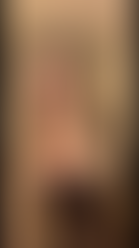 Geblurrte Content-Vorschau