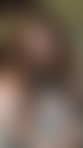 Geblurrte Content-Vorschau