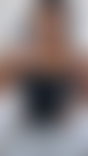 Geblurrte Content-Vorschau