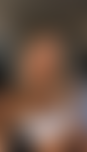 Geblurrte Content-Vorschau