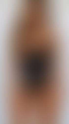 Geblurrte Content-Vorschau
