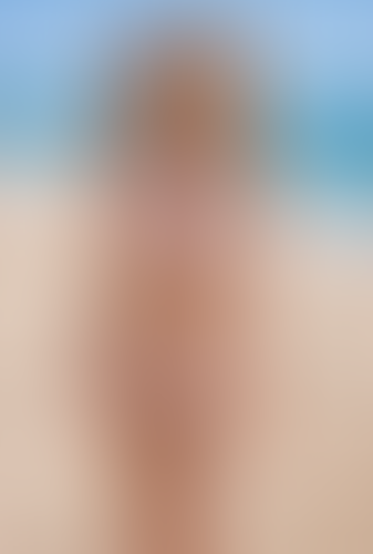 Geblurrte Content-Vorschau